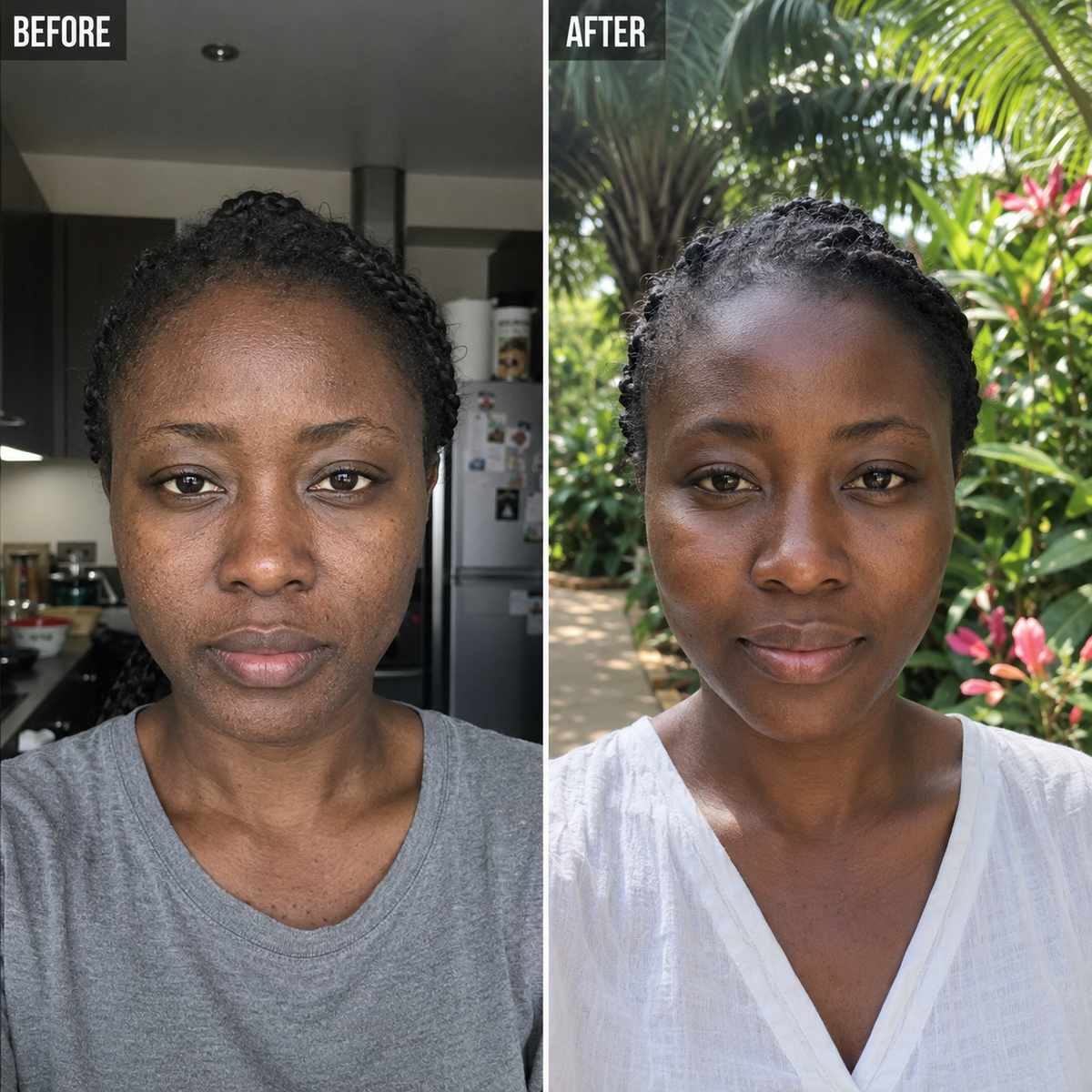Photo de transformation Velura